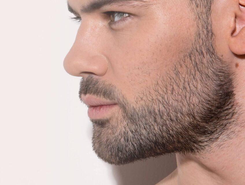 Epilation définitive au laser : barbe | technique et prix à Compiègne | Beauxmonts