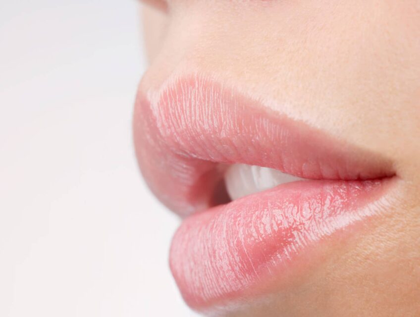 Epilation définitive au laser : lèvres | technique et prix à Compiègne | Beauxmonts